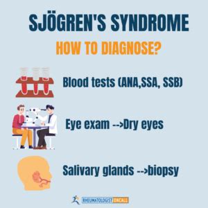 sjogren's syndrome tear test filter|how to diagnose sjogren's syndrome.